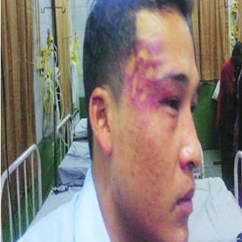 Lawyers attack friend of Naga woman who alleged molestation: Police
